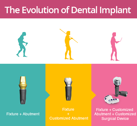 digital dental implant in sydney