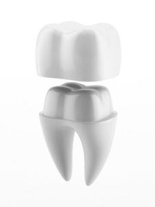 implant dentist implant dentistry